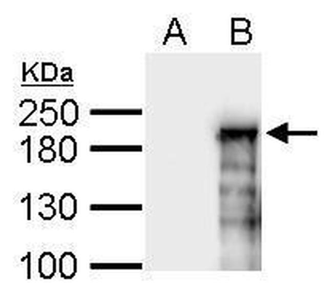 ASXL1 Antibody in Western Blot (WB)