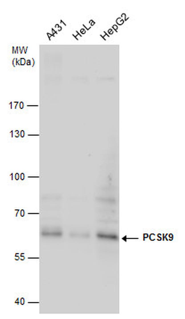 PCSK9 Antibody in Western Blot (WB)