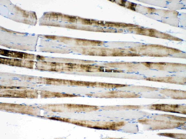 alpha Actinin 3 Antibody in Immunohistochemistry (Paraffin) (IHC (P))