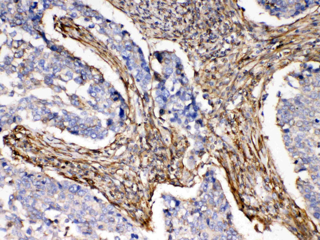 alpha Actinin 3 Antibody in Immunohistochemistry (Paraffin) (IHC (P))