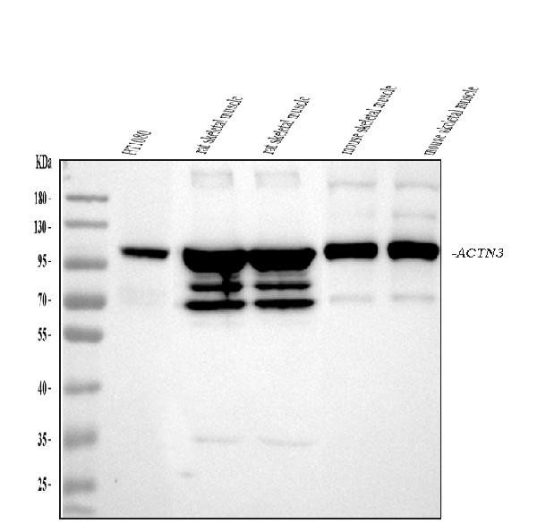 alpha Actinin 3 Antibody in Western Blot (WB)