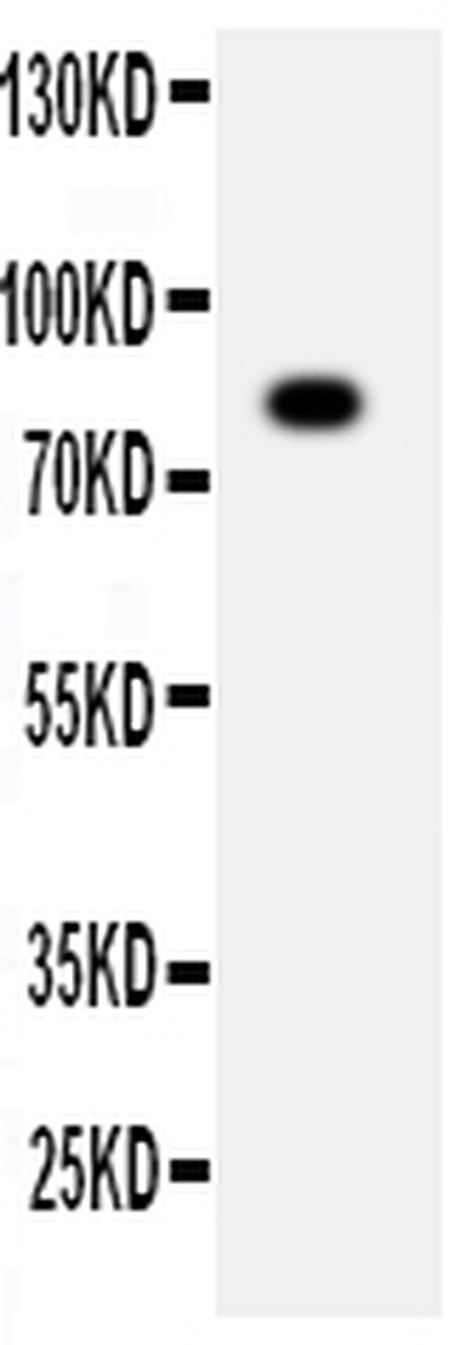 ADAM2 Antibody in Western Blot (WB)