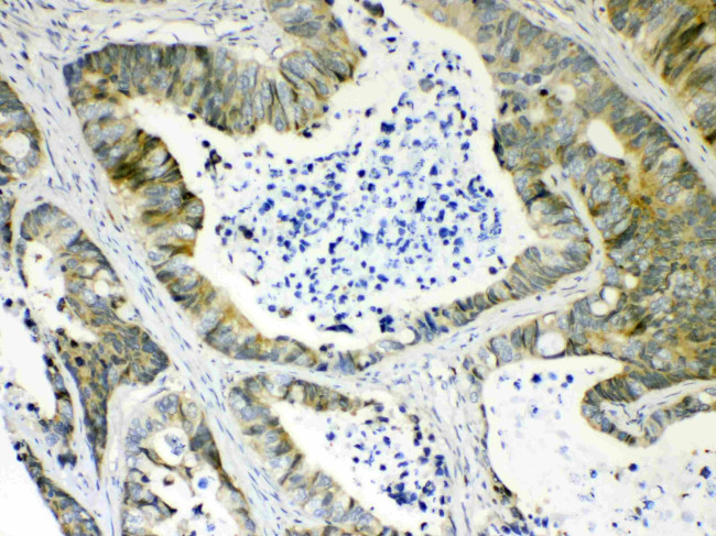 AKR1B10 Antibody in Immunohistochemistry (Paraffin) (IHC (P))