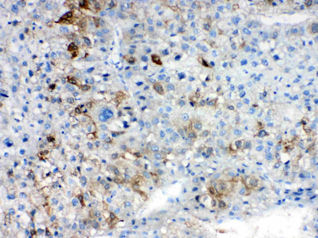 AKR1B10 Antibody in Immunohistochemistry (Paraffin) (IHC (P))