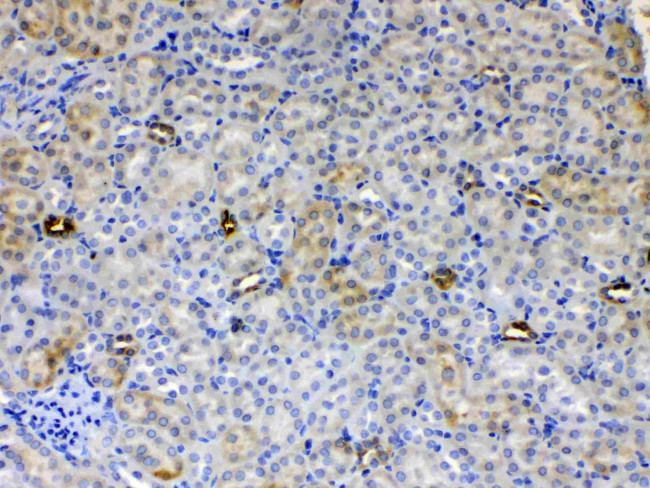 ALDH1A3 Antibody in Immunohistochemistry (Paraffin) (IHC (P))