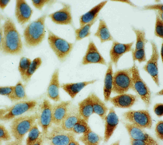 Annexin V Antibody in Immunocytochemistry (ICC/IF)