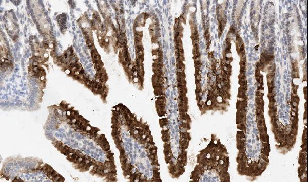 API5 Antibody in Immunohistochemistry (Paraffin) (IHC (P))