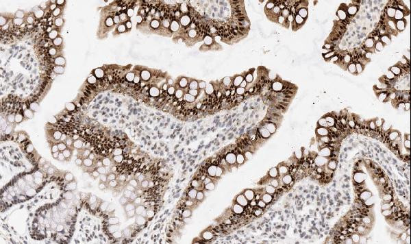 API5 Antibody in Immunohistochemistry (Paraffin) (IHC (P))