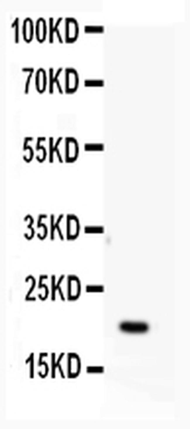 APRT Antibody in Western Blot (WB)