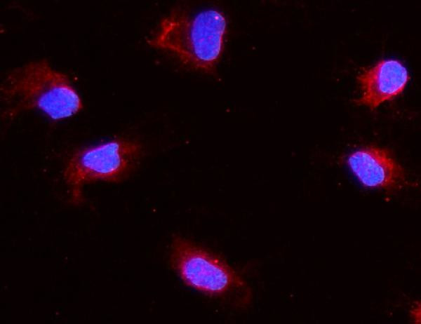 Aquaporin 1 Antibody in Immunocytochemistry (ICC/IF)