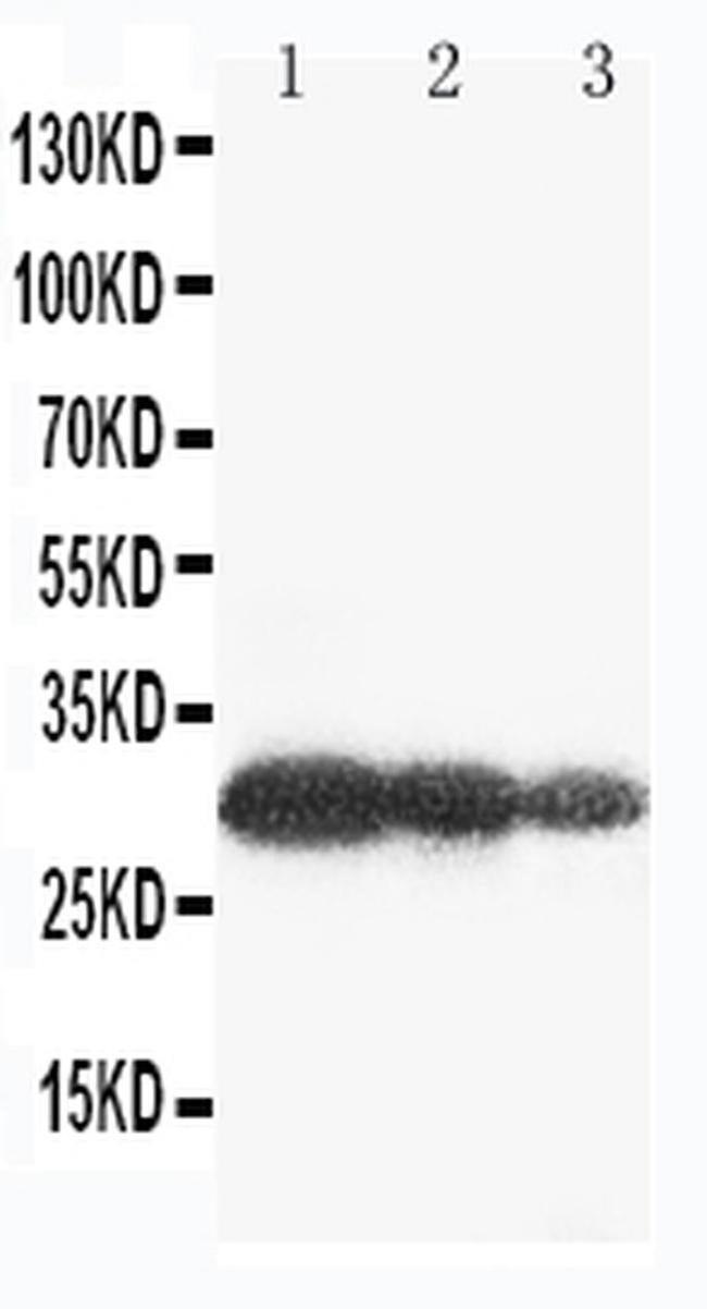 Aquaporin 6 Antibody in Western Blot (WB)