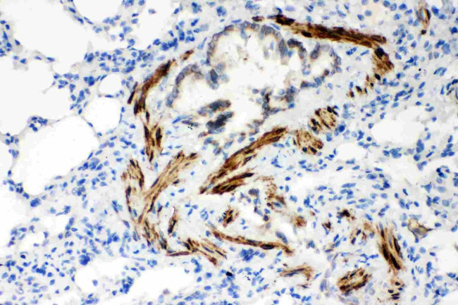 SERCA2 ATPase Antibody in Immunohistochemistry (Paraffin) (IHC (P))