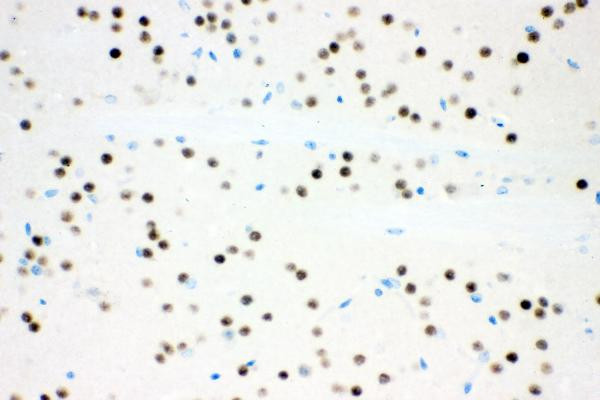 Ataxin 1 Antibody in Immunohistochemistry (Paraffin) (IHC (P))