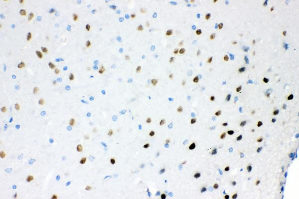 Ataxin 1 Antibody in Immunohistochemistry (Paraffin) (IHC (P))