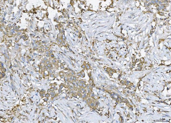 Ataxin 2 Antibody in Immunohistochemistry (Paraffin) (IHC (P))