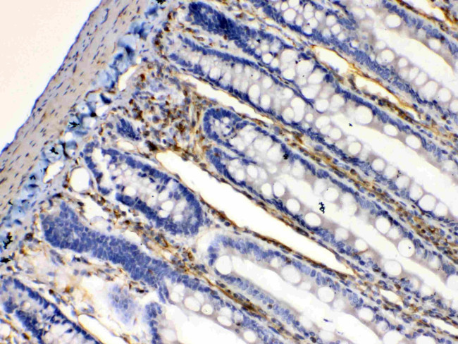 BAG1 Antibody in Immunohistochemistry (Paraffin) (IHC (P))