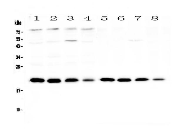 BNIP3 Antibody in Western Blot (WB)