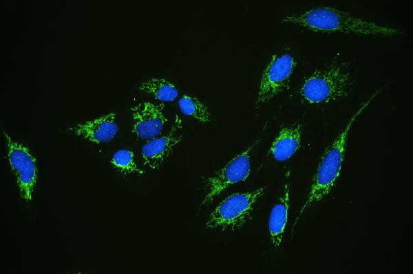 C1QBP Antibody in Immunocytochemistry (ICC/IF)