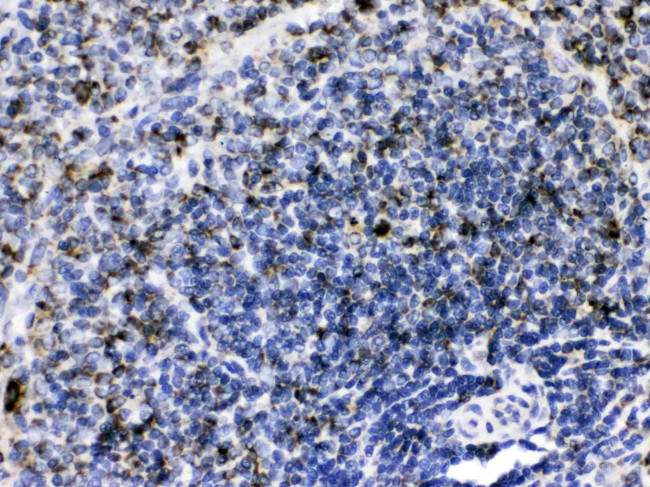 C1QBP Antibody in Immunohistochemistry (Paraffin) (IHC (P))