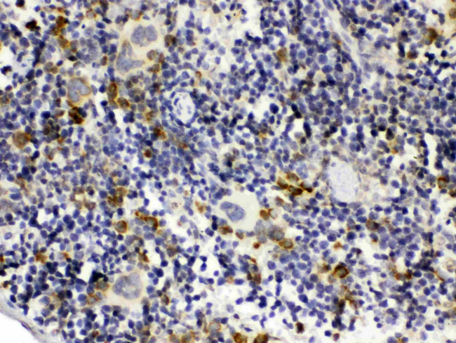 C1QBP Antibody in Immunohistochemistry (Paraffin) (IHC (P))