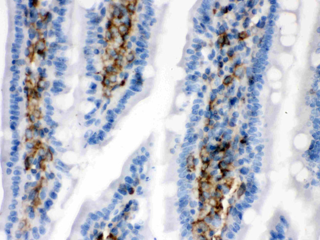 Caldesmon Antibody in Immunohistochemistry (Paraffin) (IHC (P))