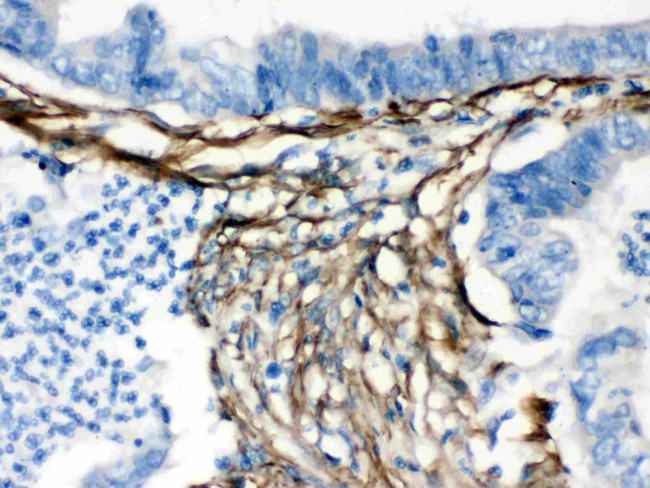 Caldesmon Antibody in Immunohistochemistry (Paraffin) (IHC (P))