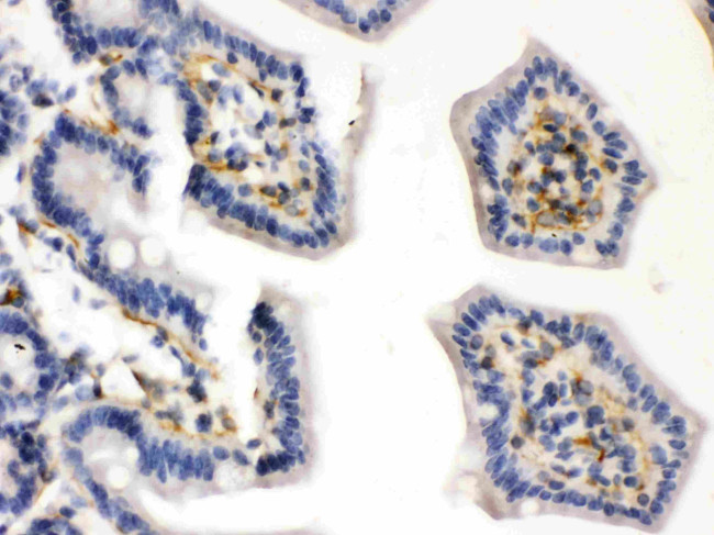 Caldesmon Antibody in Immunohistochemistry (Paraffin) (IHC (P))