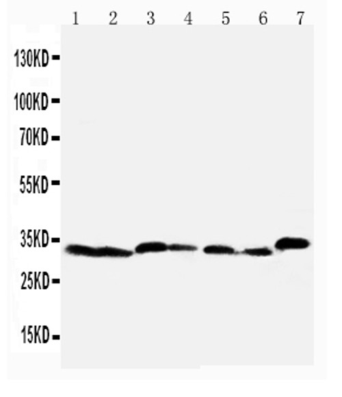 Caspase 6 p18 Antibody in Western Blot (WB)