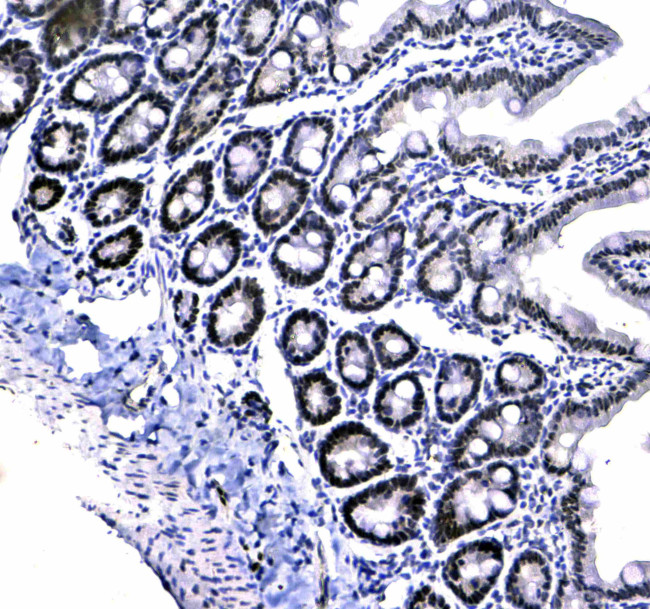 HP1 gamma Antibody in Immunohistochemistry (Paraffin) (IHC (P))