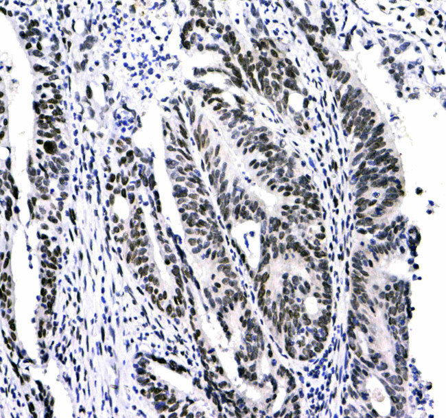 HP1 gamma Antibody in Immunohistochemistry (Paraffin) (IHC (P))