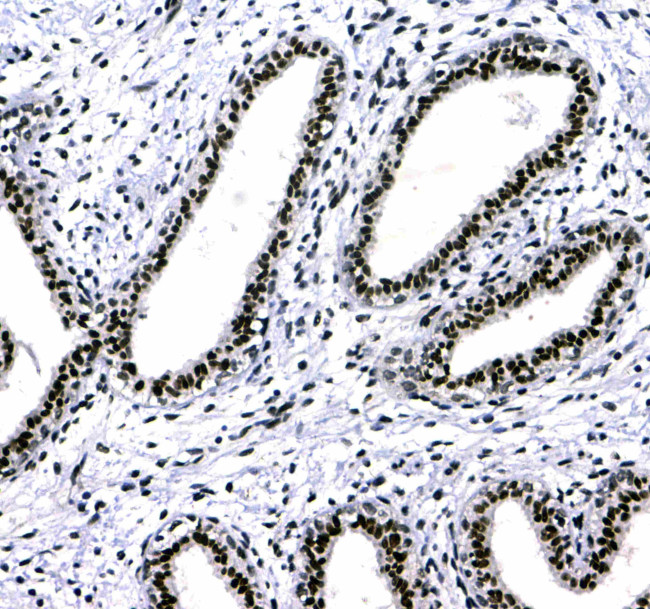 HP1 gamma Antibody in Immunohistochemistry (Paraffin) (IHC (P))