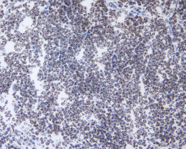 HP1 gamma Antibody in Immunohistochemistry (Frozen) (IHC (F))