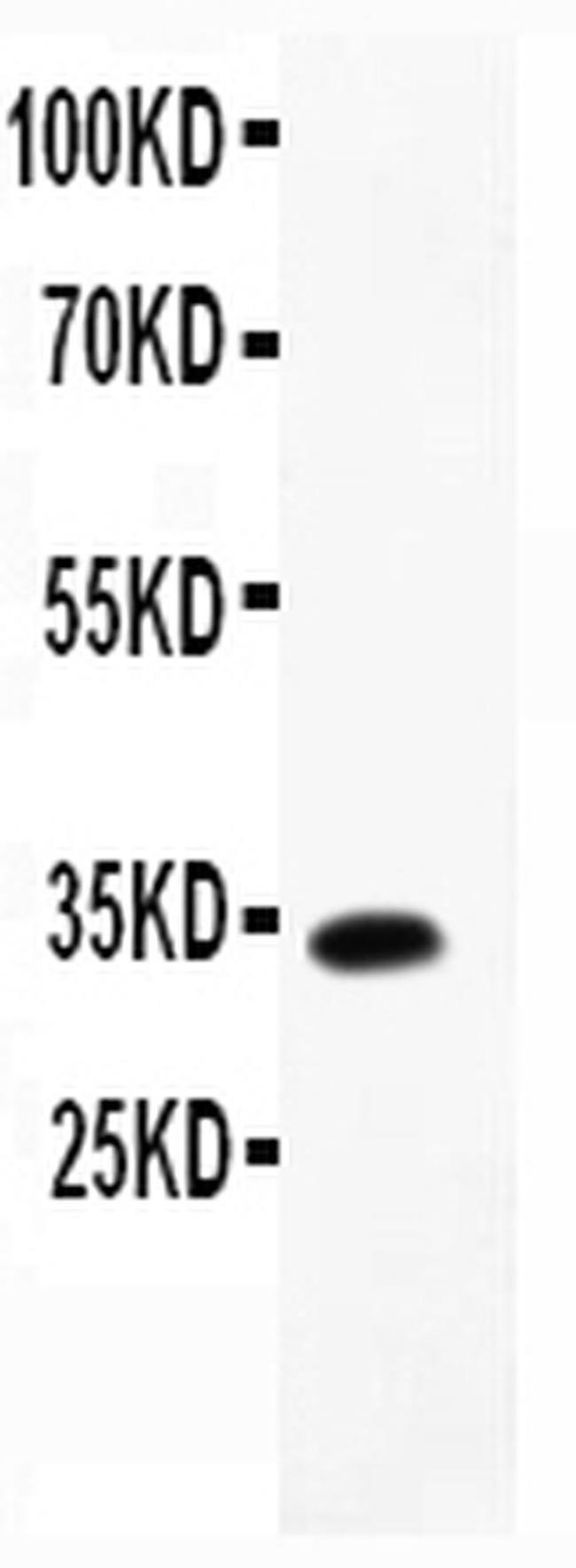 MCP-4 Antibody in Western Blot (WB)