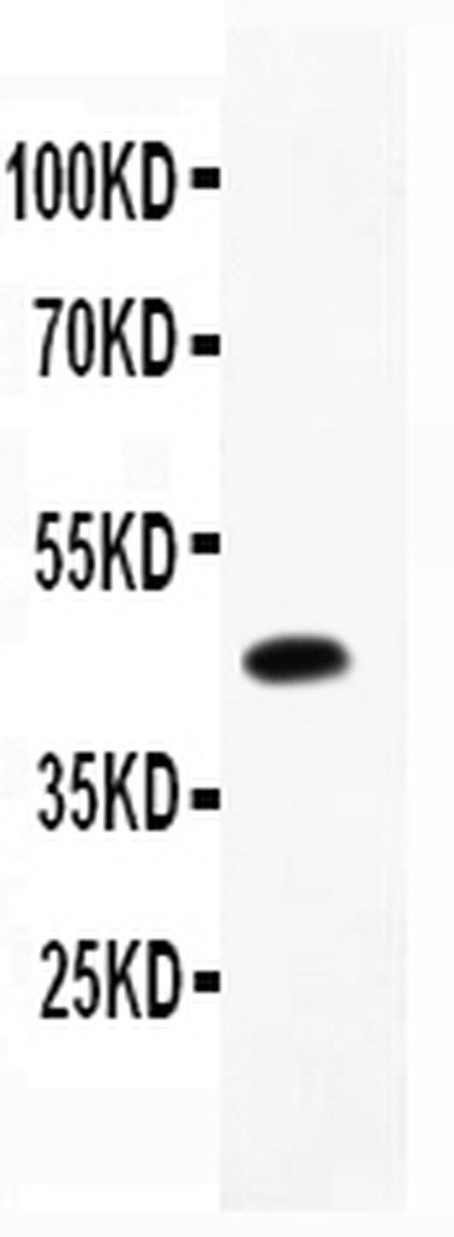 CD79b Antibody in Western Blot (WB)
