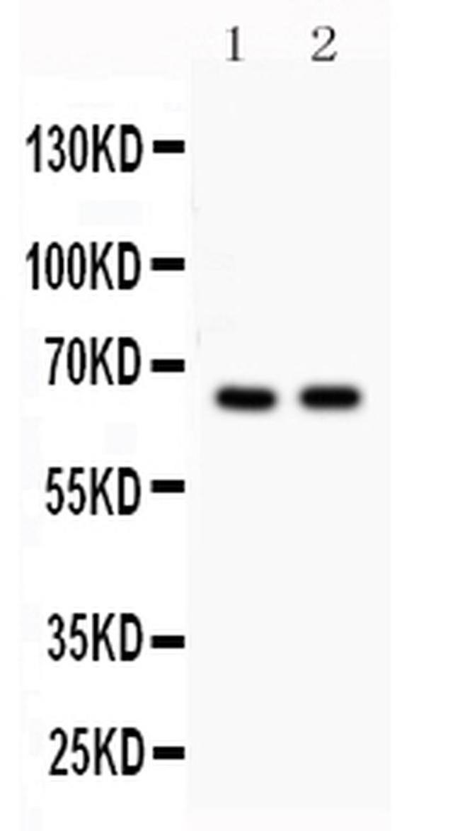 CDC25B Antibody in Western Blot (WB)