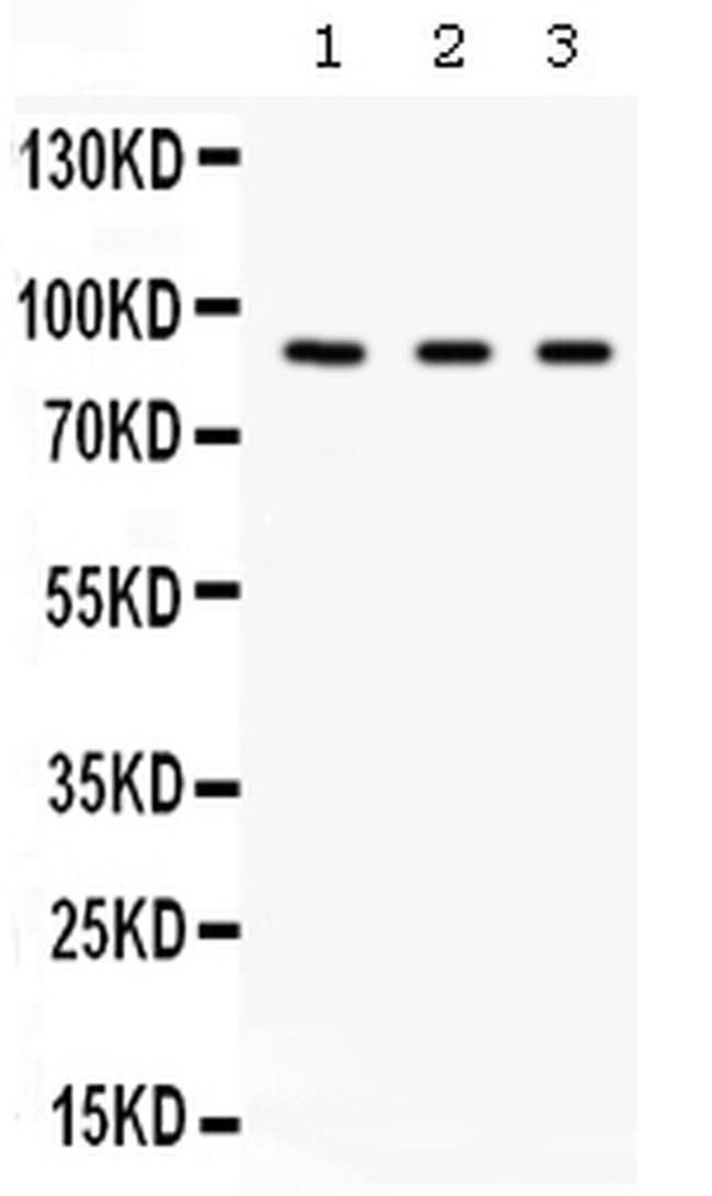 Complement Factor B Antibody in Western Blot (WB)