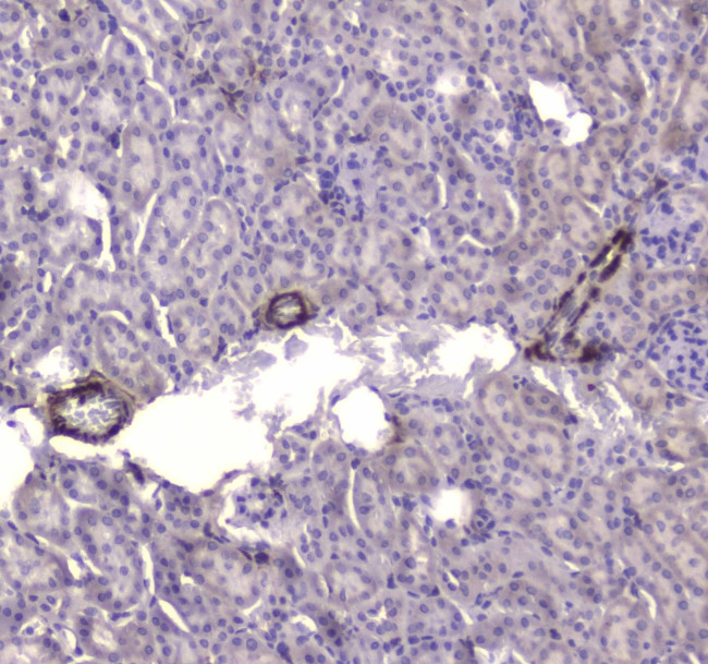 Creatine Kinase BB Antibody in Immunohistochemistry (Paraffin) (IHC (P))