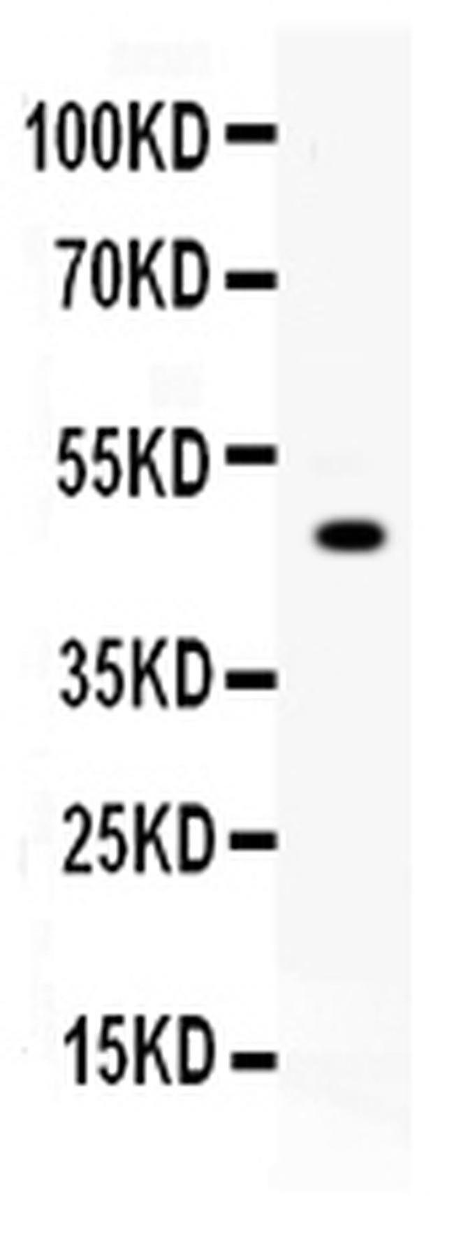 Carboxypeptidase B2 Antibody in Western Blot (WB)