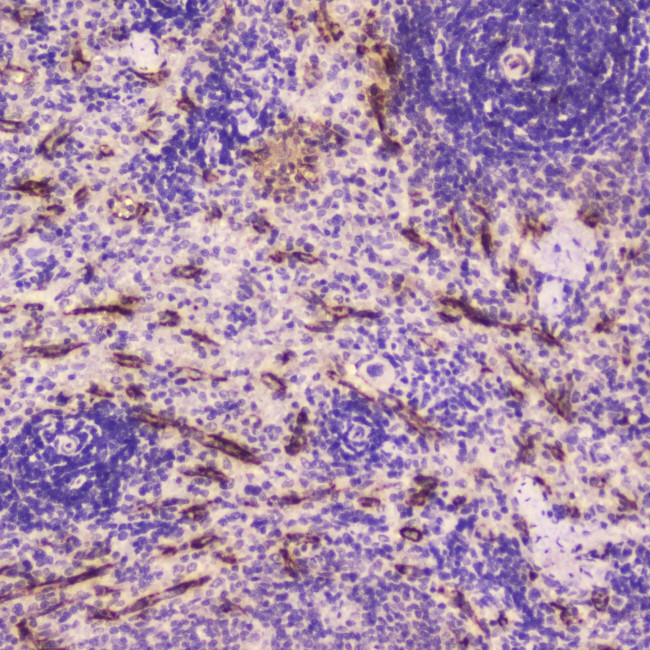 CRP Antibody in Immunohistochemistry (Paraffin) (IHC (P))