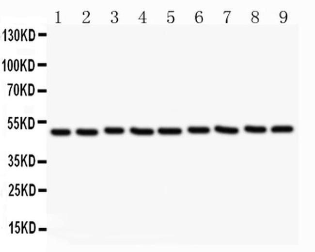 CSK Antibody in Western Blot (WB)