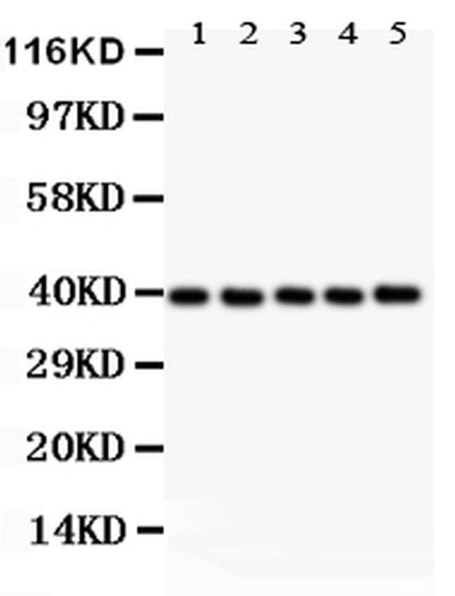 CXCR6 Antibody in Western Blot (WB)