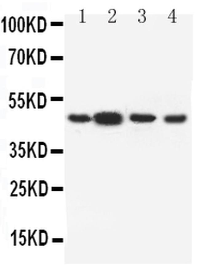 DRD3 Antibody in Western Blot (WB)
