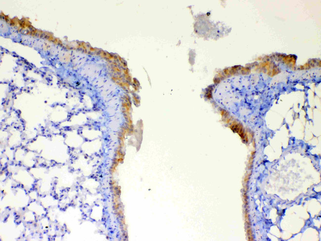 DYNLT1 Antibody in Immunohistochemistry (Paraffin) (IHC (P))