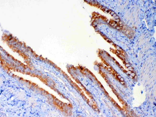 DYNLT1 Antibody in Immunohistochemistry (Paraffin) (IHC (P))