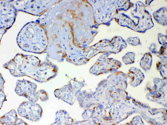 DYNLT1 Antibody in Immunohistochemistry (Paraffin) (IHC (P))