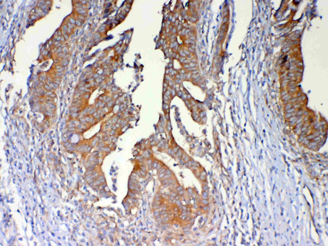 DYNLT1 Antibody in Immunohistochemistry (Paraffin) (IHC (P))