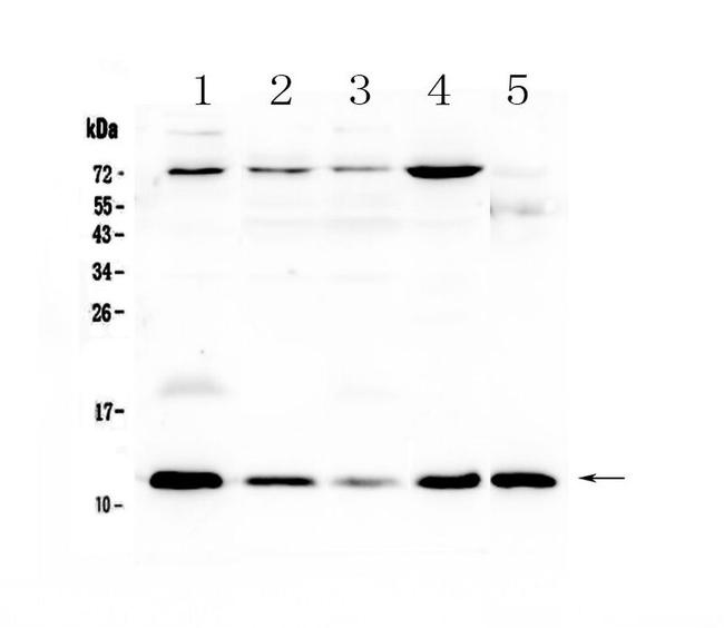 DYNLT1 Antibody in Western Blot (WB)