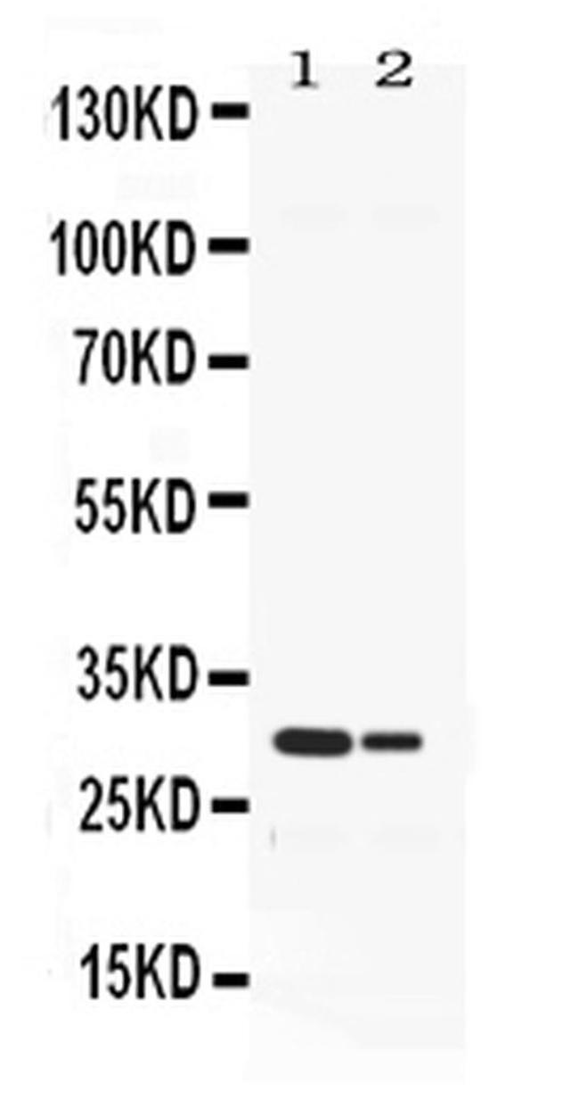 Neutrophil elastase Antibody in Western Blot (WB)