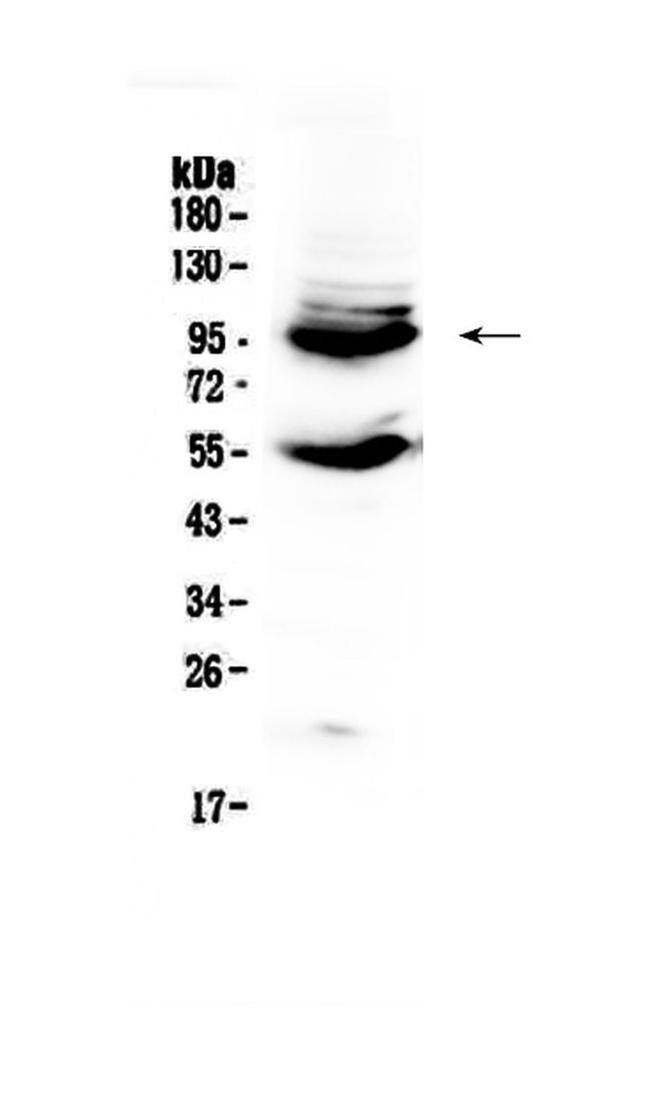 CD105 (Endoglin) Antibody in Western Blot (WB)