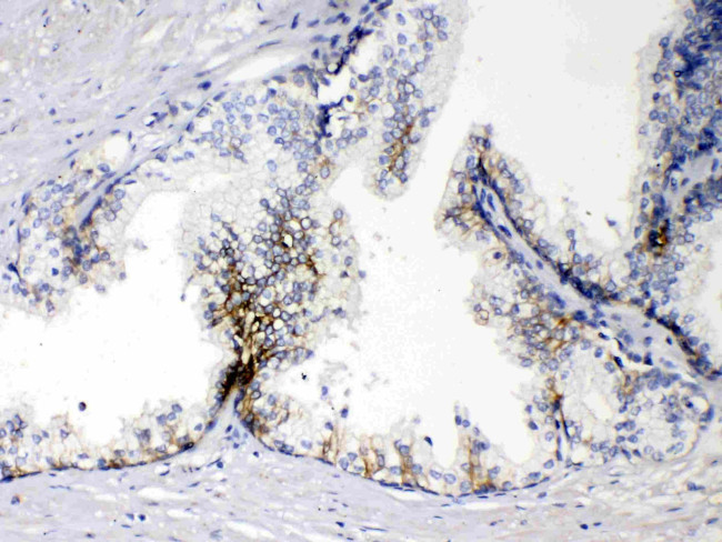 EpCAM (CD326) Antibody in Immunohistochemistry (Paraffin) (IHC (P))